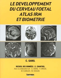 Image de DEVELOPPEMENT DU CERVEAU FOETAL