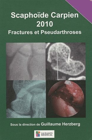 Picture of SCAPHOIDE CARPIEN 2010 FRACTURES ET PSEUDOARTHROSES
