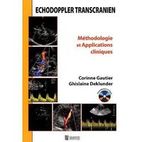 Image de ECHODOPPLER TRANSCRANIEN METHODOLOGIE ET APPLICATIONS CLINIQUES
