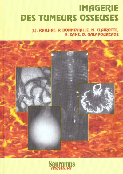 Image de IMAGERIE DES TUMEURS OSSEUSES