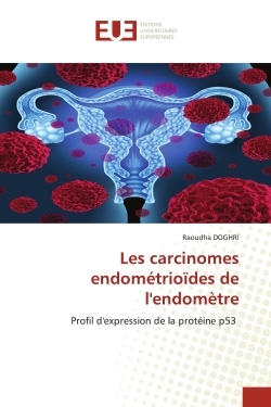 Picture of Les carcinomes endométrioïdes de l'endomètre