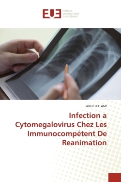 Picture of Infection a Cytomegalovirus Chez Les Immunocompétent De Reanimation