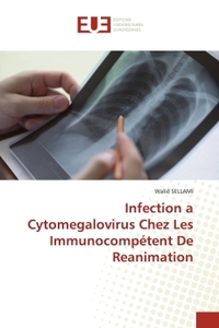 Picture of Infection a Cytomegalovirus Chez Les Immunocompétent De Reanimation