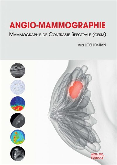 Picture of ANGIO-MAMMOGRAPHIE