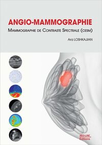 Picture of ANGIO-MAMMOGRAPHIE