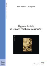 Picture of Hypoxie foetale et lésions cérébrales associées