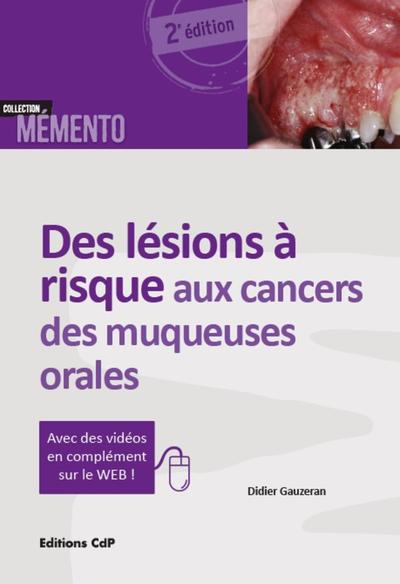 Picture of Des lésions à risque aux cancers des muqueuses orales
