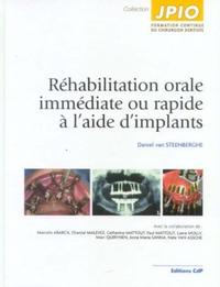 Picture of Réhabilitation orale immédiate ou rapide à l'aide d'implants