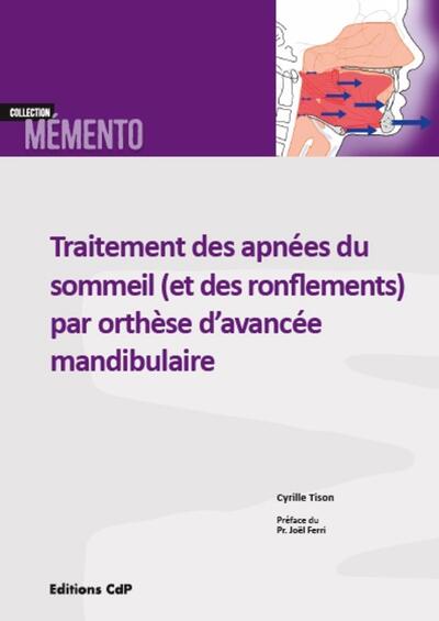 Picture of Traitement des apnées du sommeil (et des ronflements) par orthèse d'avancée mandibulaire