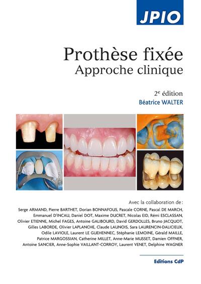Prothèse fixée, 2e Ed., Approche clinique (9782843614491-front-cover)
