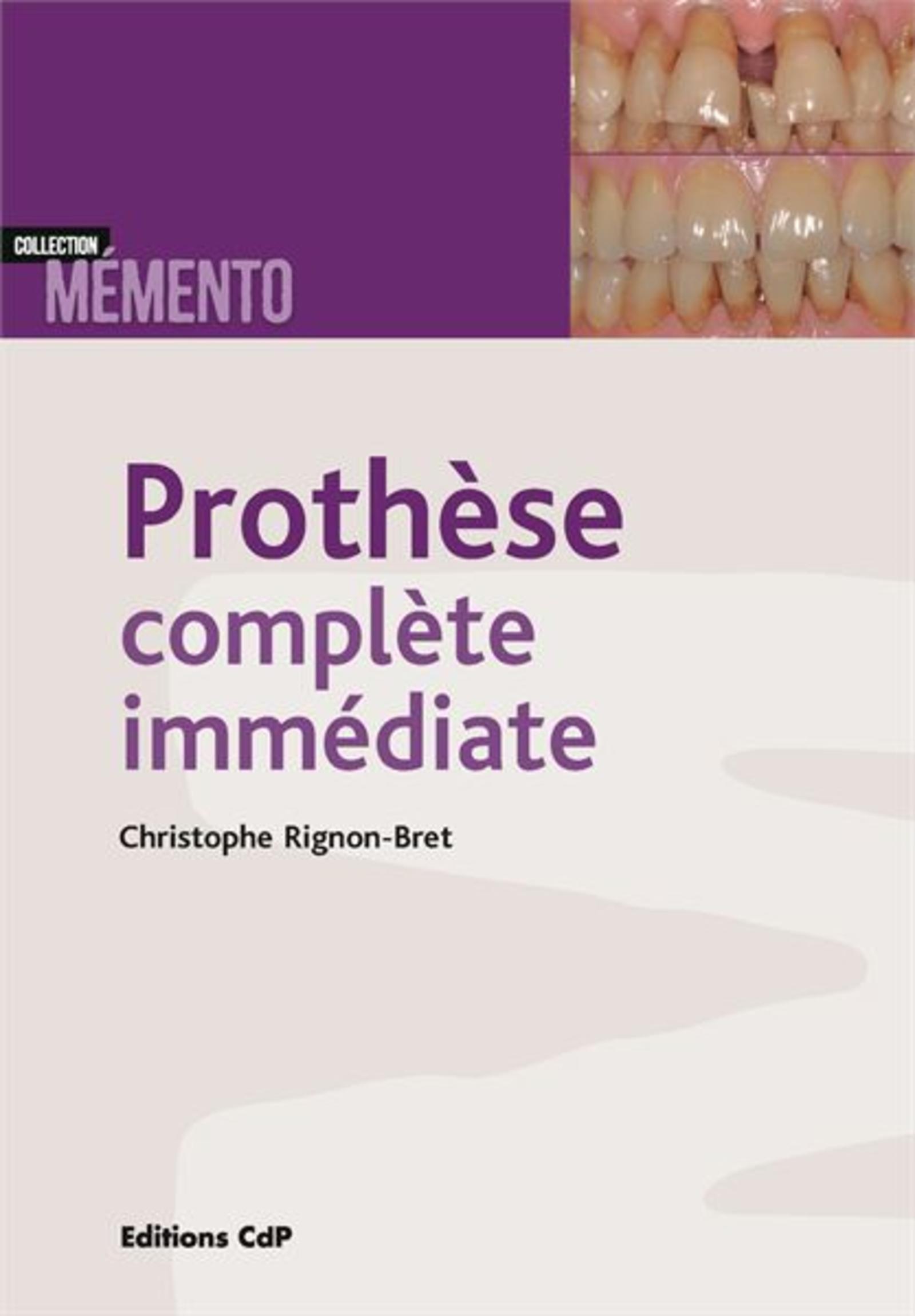 Prothèse complète immédiate (9782843614262-front-cover)