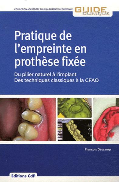 Pratique de l'empreinte en prothèse fixée, Du pilier naturel à l'implant - Des techniques classiques à la CFAO (9782843611766-front-cover)