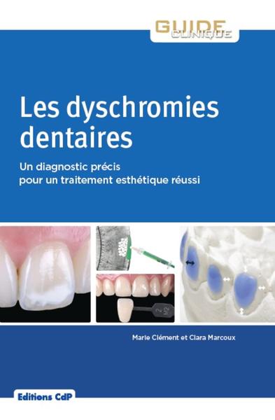 Les dyschromies dentaires, Un diagnostic précis pour un traitement esthétique réussi (9782843614217-front-cover)