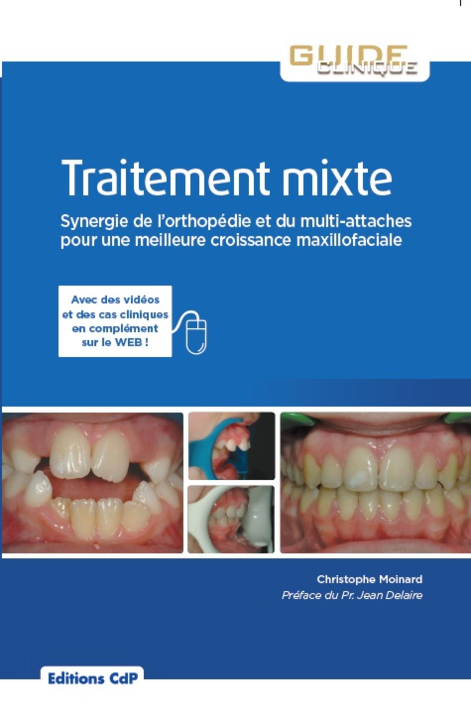 Traitement mixte, Orthopédie et multi-attaches pour une meilleure croissance maxillo-faciale. (9782843612527-front-cover)