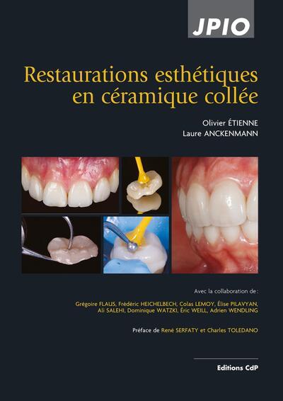 Restaurations esthétiques en céramique collée, 2e éd. (9782843614521-front-cover)