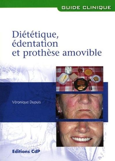 Diététique, édentation et prothèse amovible (9782843610875-front-cover)