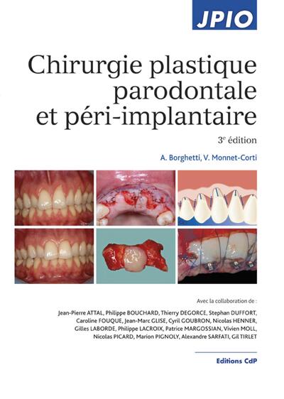 Chirurgie plastique parodontale et péri-implantaire (9782843613210-front-cover)