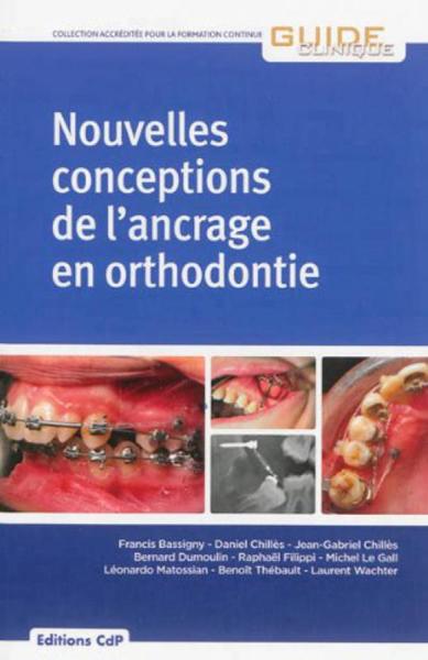 Nouvelles conceptions de l'ancrage en orthodontie (9782843612138-front-cover)