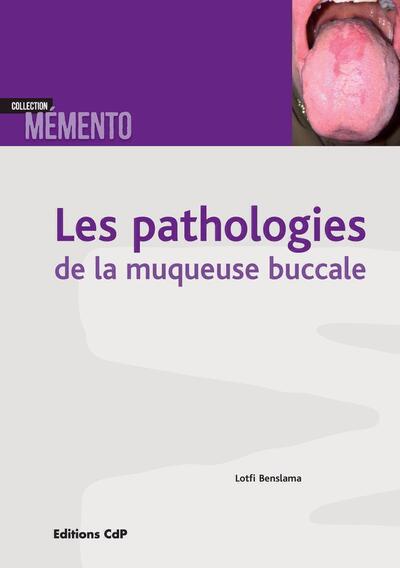Les pathologies de la muqueuse buccale (9782843614569-front-cover)