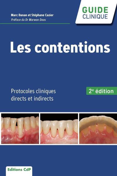 Les contentions, Protocoles cliniques directs et indirects (9782843614538-front-cover)