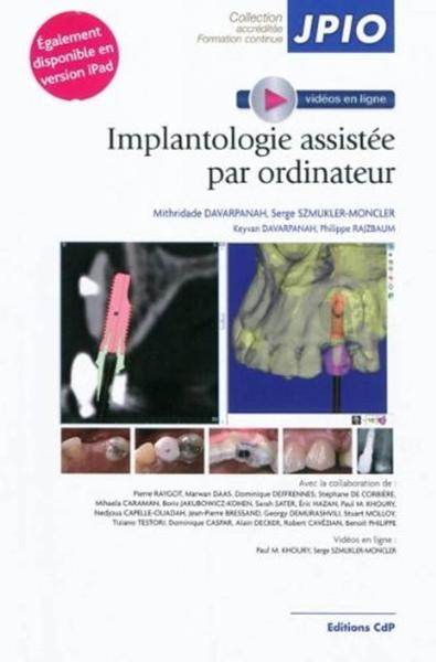 Implantologie assistée par ordinateur (9782843611582-front-cover)