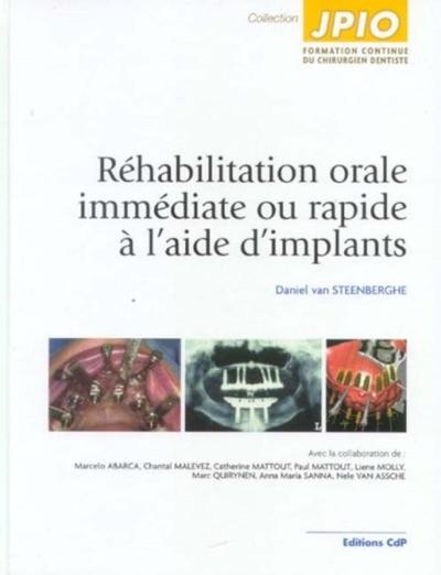 Réhabilitation orale immédiate ou rapide à l'aide d'implants (9782843610981-front-cover)