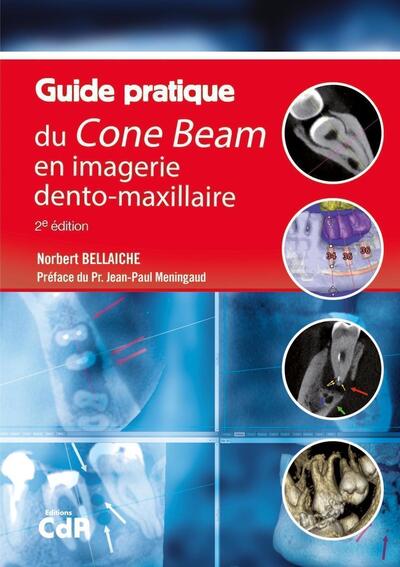 Guide pratique du Cone Beam en imagerie dento-maxillaire (9782843614484-front-cover)