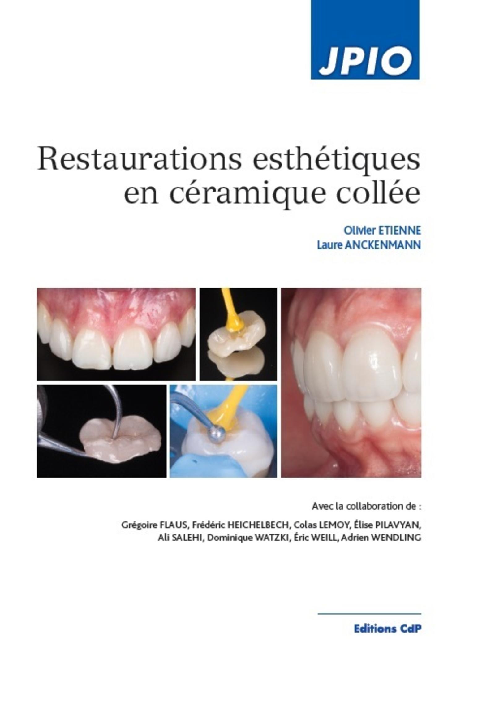 Restaurations esthétiques en céramique collée (9782843613227-front-cover)