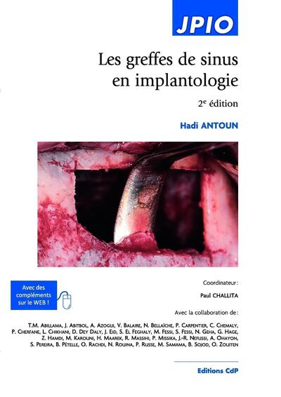 Les greffes de sinus en implantologie, 2E EDITION (9782843614293-front-cover)