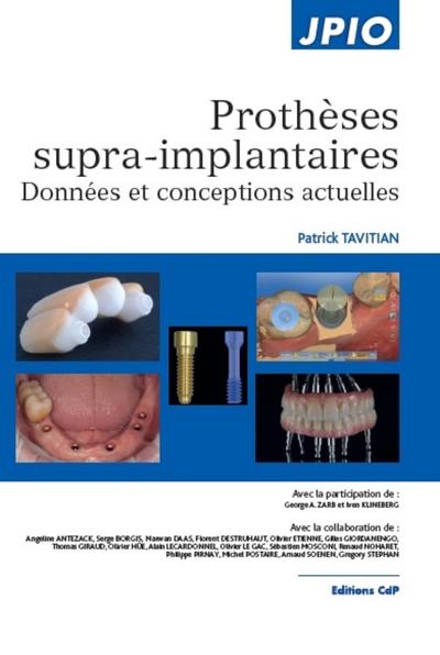 Prothèses supra-implantaires, Données et conceptions actuelles (9782843614026-front-cover)