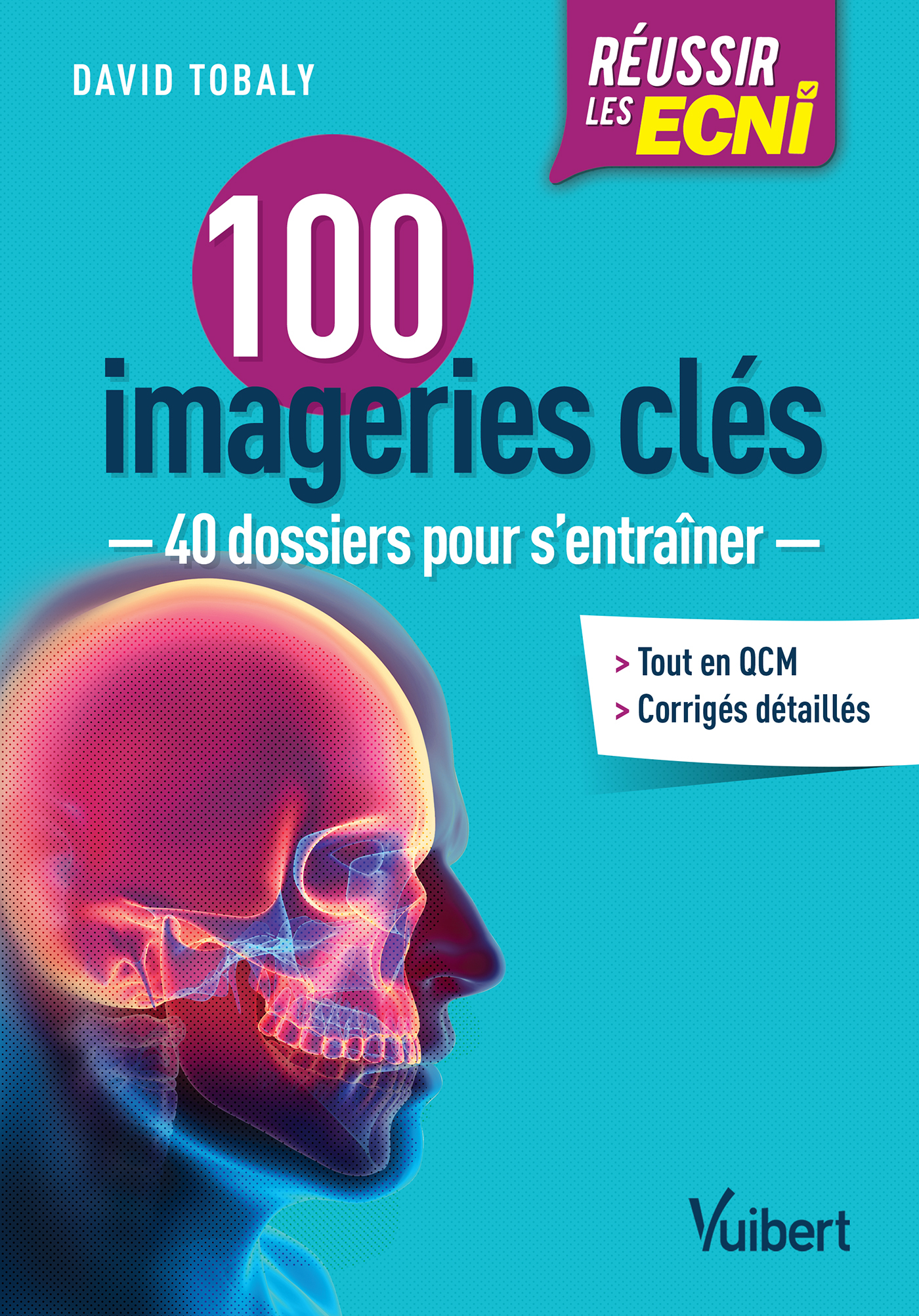 Réussir les ECNi - 100 imageries clés, 40 dossiers pour s'entraîner (9782843719264-front-cover)