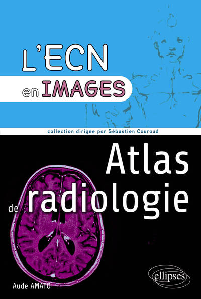 Atlas de radiologie (9782729876036-front-cover)