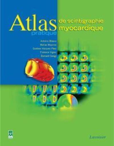 Atlas pratique de scintigraphie myocardique (9782743008352-front-cover)