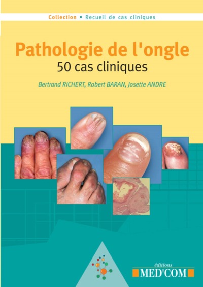 PATHOLOGIE DE L ONGLE  50 CAS CLINIQUES (9782914738330-front-cover)