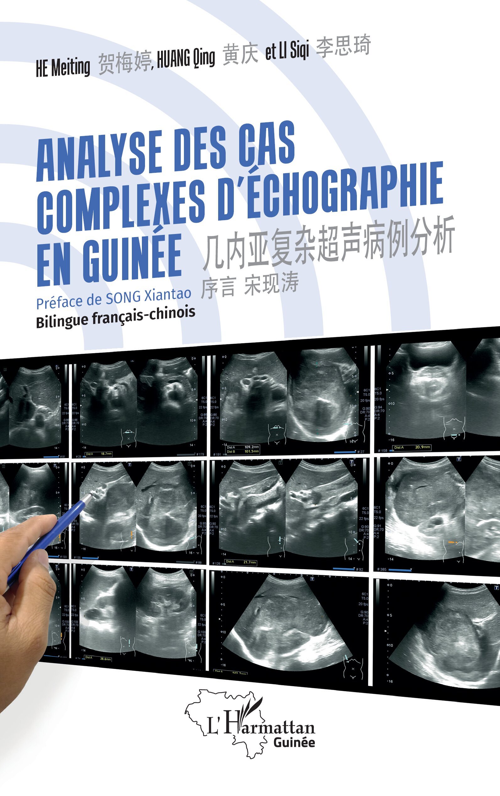 Analyse des cas complexes d'échographie en Guinée, 几内亚复杂超声病例分析 Bilingue français-chinois (9782336501345-front-cover)