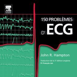 150 problèmes d'ECG (9782810101498-front-cover)