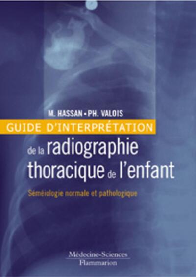 Guide d'interprétation de la radiographie thoracique de l'enfant : séméiologie normale et pathologique (9782257100948-front-cover)