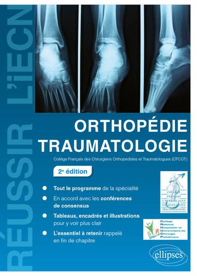 Orthopédie Traumatologie - 2e édition (9782340032828-front-cover)