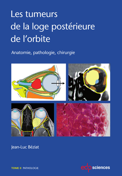 Les tumeurs de la loge postérieure de l'orbite - Tome 2, Tome 2 (9782759819348-front-cover)