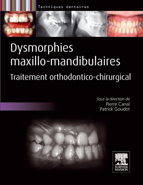 Dysmorphies maxillo-mandibulaires, Traitement orthodontico-chirurgical (9782294710070-front-cover)