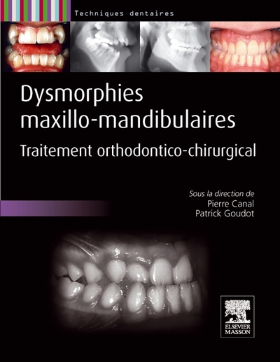 Dysmorphies maxillo-mandibulaires, Traitement orthodontico-chirurgical (9782294710070-front-cover)