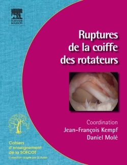 Ruptures de la coiffe des rotateurs (9782294713187-front-cover)