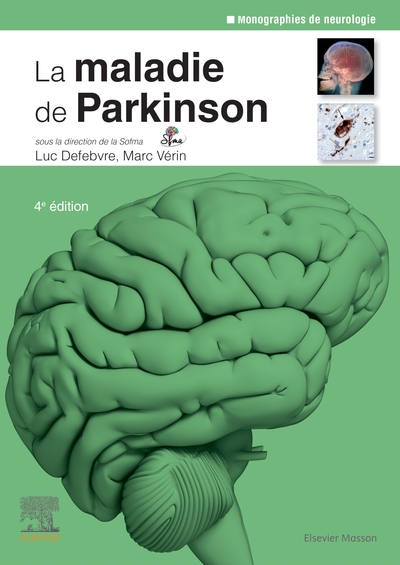 La maladie de Parkinson (9782294768026-front-cover)