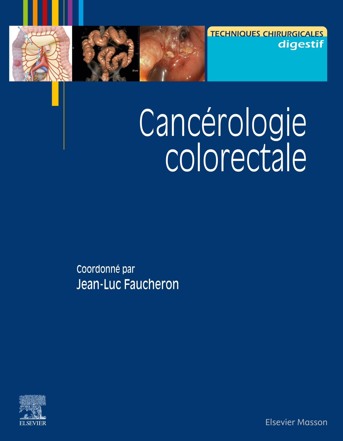 Cancérologie colorectale (9782294774546-front-cover)