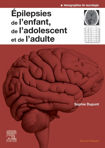 Epilepsies de l'enfant, de l'adolescent et de l'adulte, De la physiopathologie à la prise en charge (9782294762789-front-cover)