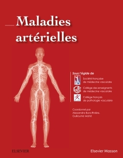 Maladies artérielles (9782294749704-front-cover)