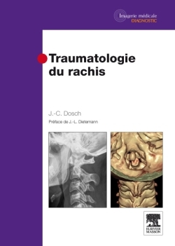 Traumatologie du rachis (9782294705991-front-cover)