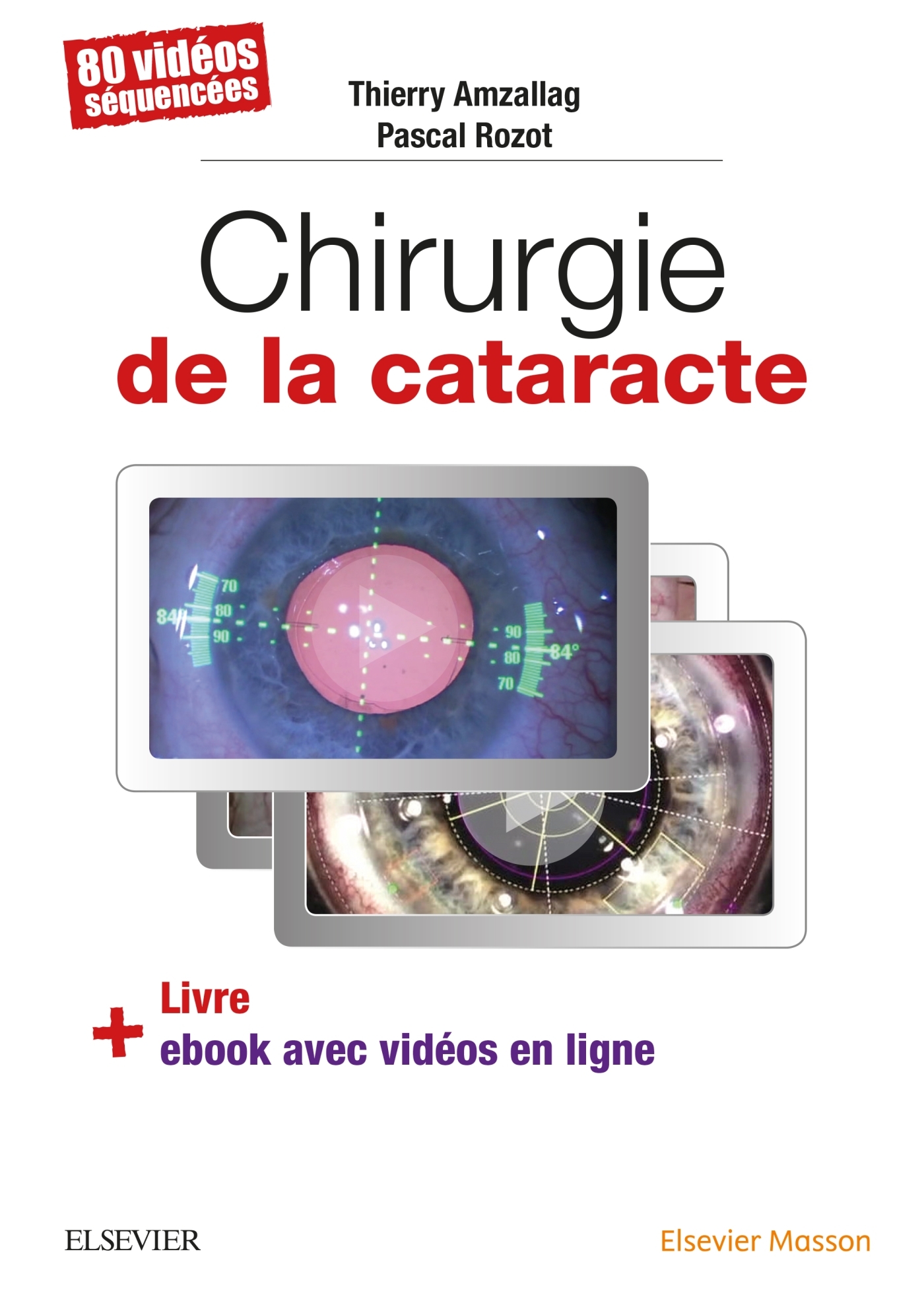 Chirurgie de la cataracte, 60 Videos Sequencees (9782294757372-front-cover)