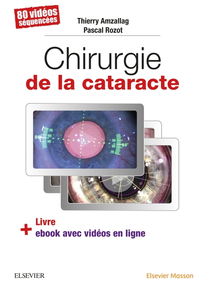 Chirurgie de la cataracte, 60 Videos Sequencees (9782294757372-front-cover)