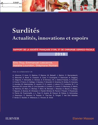 Surdités, Actualités, innovations et espoirs (9782294761317-front-cover)